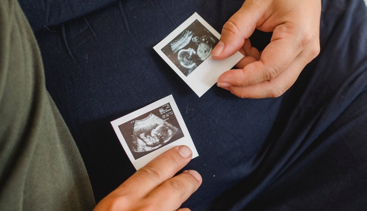 CBD and Fertility: What Science Says About its Effects - VO Inc