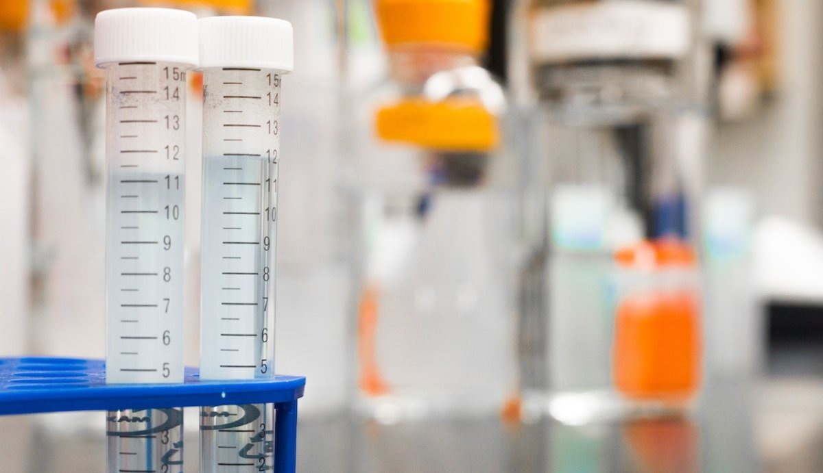 Will Hemp Delta-9 Show Up on a Drug Test? - VO Inc